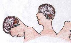 Что представляет собой диффузное повреждение головного мозга?