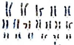 Linear chromosome ng bakterya