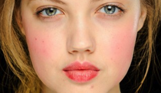 hogyan lehet eltávolítani a vörös foltokat az arcon a férfiaknál